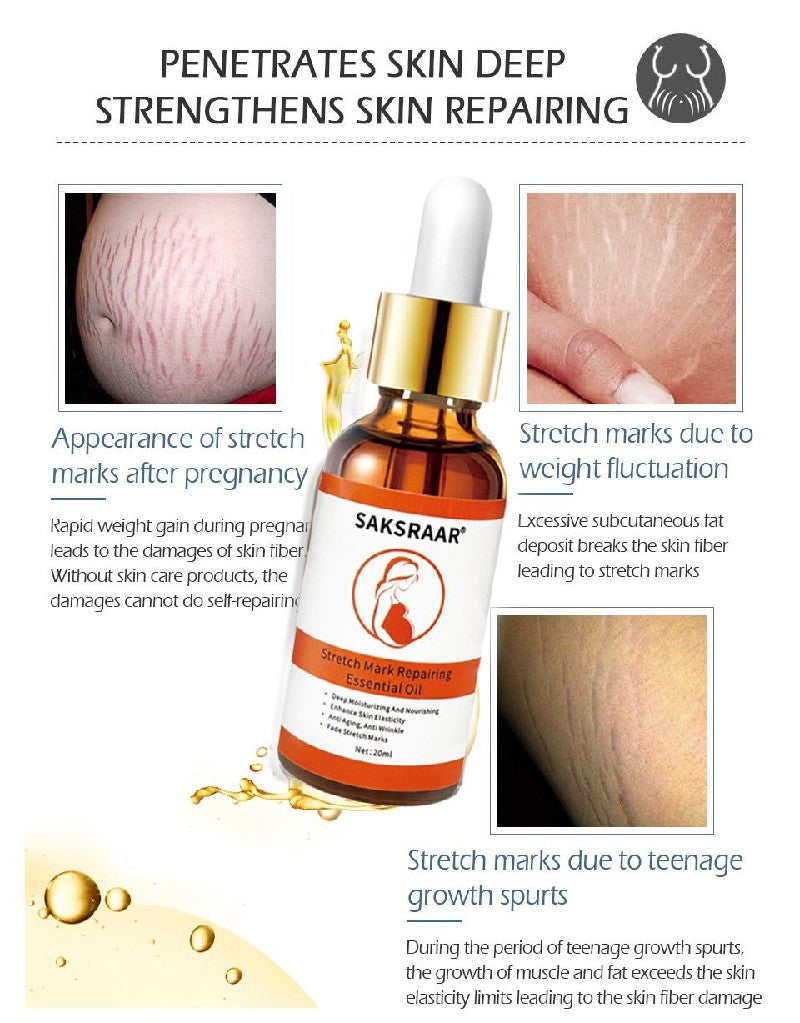 Stretch Mark Remover Essential Oil Care Cream