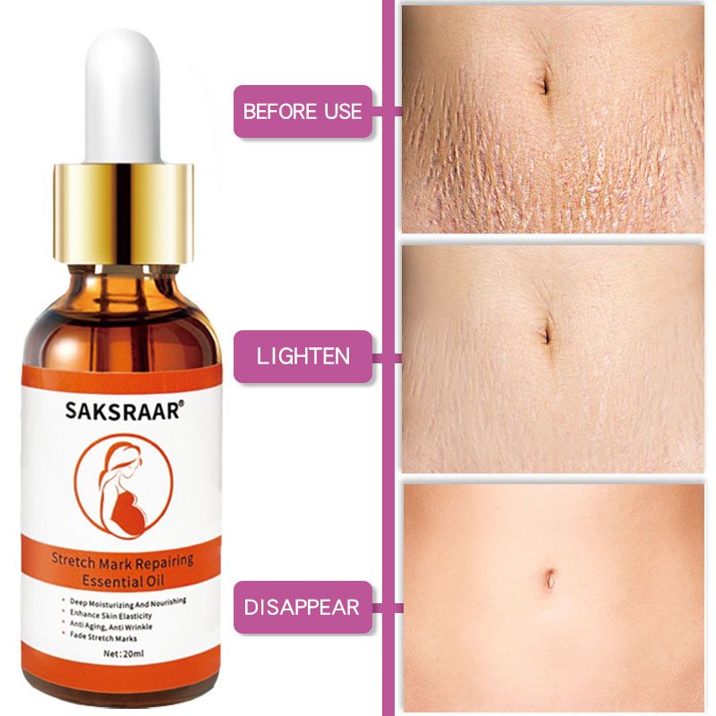 Stretch Mark Remover Essential Oil Care Cream